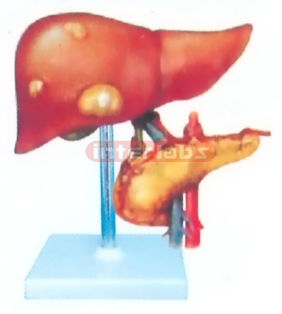 CANCER DISEASE LIVER AND PANCREAS MODEL WITH DESCRIPTION PLATE Manufacturers and Suppliers From Ambala India