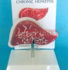 DESK TYPE CHRONIC HEPATATIS MODEL WITH DESCRIPTION PLATE Manufacturers and Suppliers From Ambala India