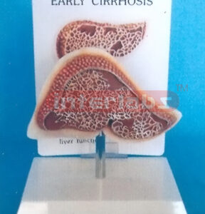 DESK TYPE EARLY CIRRHOSIS MODEL WITH DESCRIPTION PLATE Manufacturers and Suppliers From Ambala India