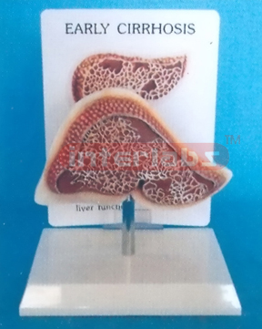 DESK TYPE EARLY CIRRHOSIS MODEL WITH DESCRIPTION PLATE Manufacturers and Suppliers From Ambala India