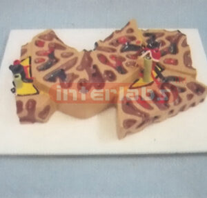 LIVER FOLIOCLE MODEL (A TYPE) Manufacturers and Suppliers From Ambala India
