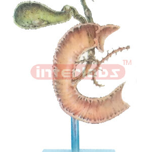 HUMAN GALL STONE MODEL Manufacturers and Suppliers From Ambala India