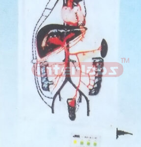 ELECTRIC PORTAL VEIN CIRCULATION MODEL Manufacturers and Suppliers From Ambala India