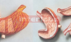 BIG STOMACH WITH BLOOD VESSEL