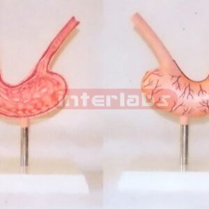 DISEASE STOMACH MODEL WITH DESCRIPTION PLATE Manufacturers and Suppliers From Ambala India