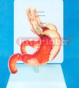 DESK TYPE HUMAN COMMON PATHOLOGIES OF STOMACH MODEL WITH DESCRIPTION PLATE Manufacturers and Suppliers From Ambala India