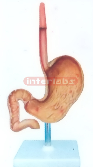 ULCERS STOMACH MODEL WITH DESCRIPTION PLATE Manufacturers and Suppliers From Ambala India