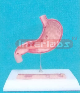 HUMAN ULCER STOMACH MODEL Manufacturers and Suppliers From Ambala India