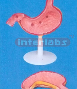 BIG DISEASED ANATOMICAL MAGNIFIED STOMACH MODEL Manufacturers and Suppliers From Ambala India