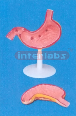 BIG DISEASED ANATOMICAL MAGNIFIED STOMACH MODEL Manufacturers and Suppliers From Ambala India