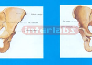 HUMAN FEMALE HEALTH PELVIS COMPARISON MODEL Exporter & Educa
