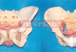 HEALTH PELVIS MODEL OF BOTH FEMALE AND MALE'S REPRODUCTIVE O