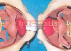 HUMAN FEMALE UNFINE PELVIS MODEL Exporter & Educational Labo