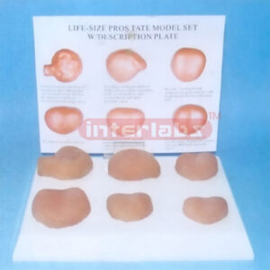 LIFE-SIZE PROSTATE MODEL SET WITH DESCRIPTION PLATE Exporter