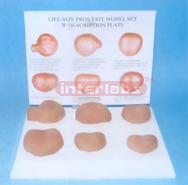 LIFE-SIZE PROSTATE MODEL SET WITH DESCRIPTION PLATE Exporter