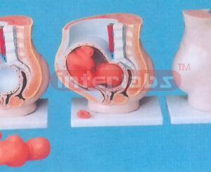 37 X 34 X 15CM GIANT SINGLE SIDE DELUXE PREGNANCY PELVIS