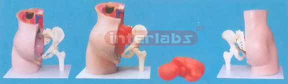 ADVANCED MODEL OF PREGNANCY
