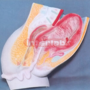 HUMAN MATERNITY POST PARTUM SHRINK OF UMBILICAL CORD MODEL E