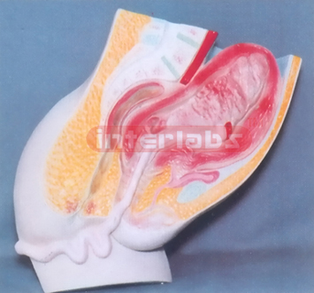 HUMAN MATERNITY POST PARTUM SHRINK OF UMBILICAL CORD MODEL E
