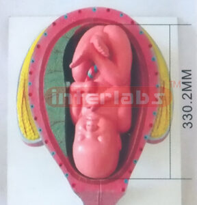 HUMAN PREGNANCY SERIES MODEL (9TH MONTH 45-46CM 2500GM) Expo