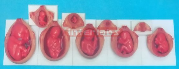 UTERUS WITH EMBRYO Exporter & Educational Laboratory Equipme