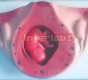 UTERUS WITH EMBRYO (3 MONTH) Exporter & Educational Laborato