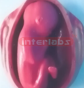 UTERUS WITH EMBRYO (9 MONTH) Exporter & Educational Laborato