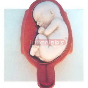 MODEL OF THE DEVELOPMENT COURSE OF HUMAN EMERYO (7 MONTH) Ex