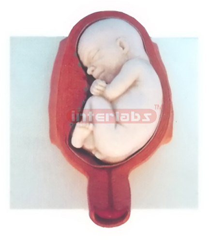 MODEL OF THE DEVELOPMENT COURSE OF HUMAN EMERYO (7 MONTH) Ex