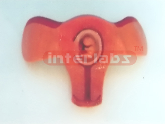 MODEL OF THE DEVELOPMENT COURSE OF HUMAN EMERYO (4 MONTH) Ex