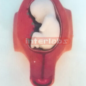 MODEL OF THE DEVELOPMENT COURSE OF HUMAN EMERYO (5 MONTH) Ex