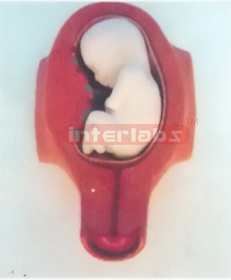 MODEL OF THE DEVELOPMENT COURSE OF HUMAN EMERYO (5 MONTH) Ex