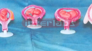 FEMALE PREGNANCY SERIES MODEL (5 PCS / SET) Exporter & Educa