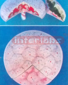HUMAN PLACENTA ANATOMISE MODEL (2 PCS) Exporter & Educationa