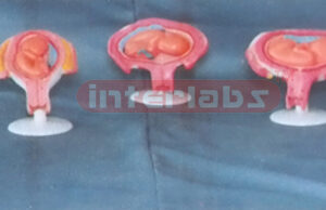 FEMALE PREGNANCY SERIES MODEL (6 PCS / SET) Exporter & Educa