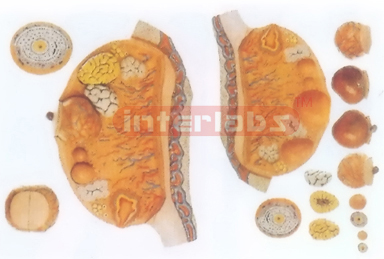 MAGNIFIED MODEL OF THE OVARY Exporter & Educational Laborato