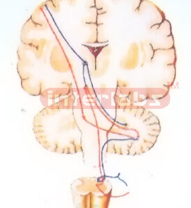 HANGING EXTRAPYRAMIDAL SYSTEM MODEL (CORTEX -PONS-CEREBELLUM
