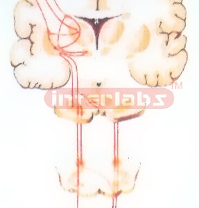 HANGING EXTRAPYRAMIDAL SYSTEM MODEL (CORPUS STRIATUM-GLOBUS