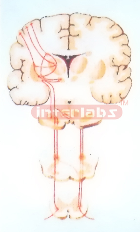 HANGING EXTRAPYRAMIDAL SYSTEM MODEL (CORPUS STRIATUM-GLOBUS