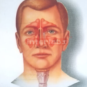 HEAD