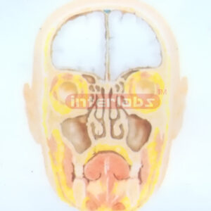 HUMAN PARANASAL SINUSES MODEL Exporter & Educational Laborat