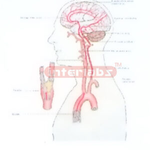 HANGING HUMAN THROMBUS PRODUCTION AND SITE PEMSTRATION IN BR