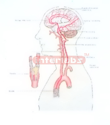 HANGING HUMAN THROMBUS PRODUCTION AND SITE PEMSTRATION IN BR