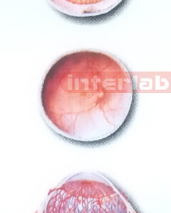 HANGING HUMAN HORIZONTAL SECTION MODEL OF THE EYEBALL Export