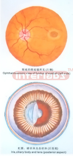 HANGING HUMAN EYE ANTERIOR AND POSTERIOR ASPECT MODEL Export
