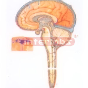 DIAGRAM OF CEREBROSPINAL FLUID CIRCULATION Exporter & Educat