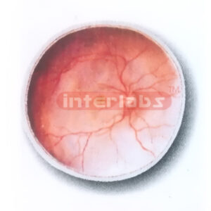 POSTERIOR PART OF THE EYEBALL (INTERNAL ASPECT) MODEL Export