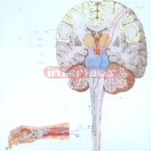 HANGING HUMAN MODEL WITH SIGNAL SETTLINGS FROM SENSORY RECEP
