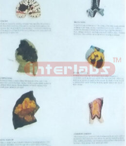 MIDDLE HUMAN THE CONSEQUENCES OF SMOKING. HANGING WOODEN PLATE (B TYPE) Manufacturers and Suppliers From Ambala India