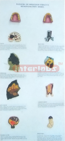 MIDDLE HUMAN THE CONSEQUENCES OF SMOKING. HANGING WOODEN PLATE (B TYPE) Manufacturers and Suppliers From Ambala India